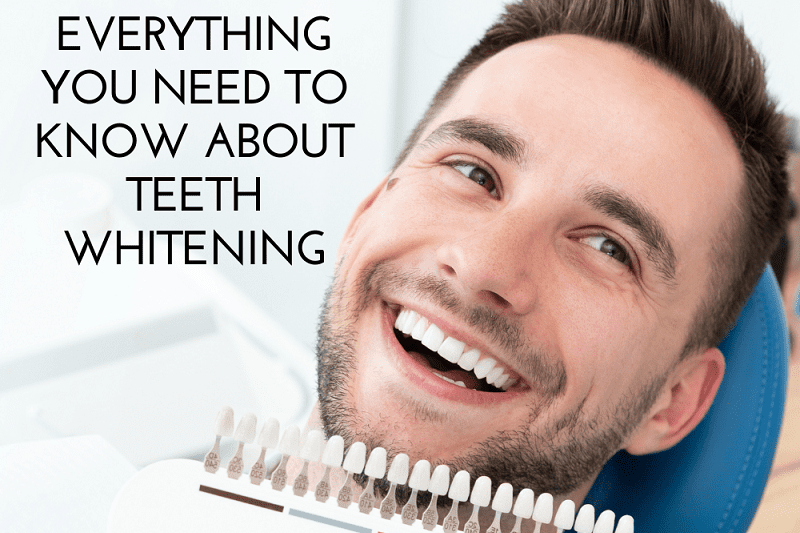 Everything You Need to Know About Teeth Whitening