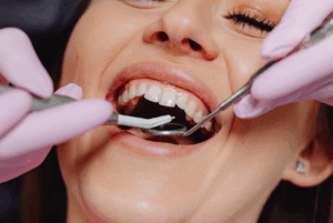 Woman getting a dental checkup